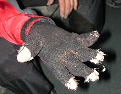 Torn Glove